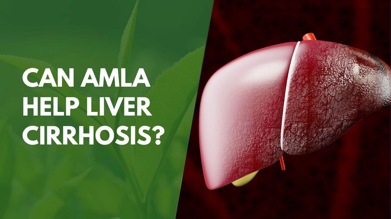 Can Amla Help Liver Cirrhosis?